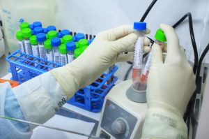 Paraná mantém liderança nacional na detecção da Covid-19 - Esse resultado só foi alcançado em função da parceria com a Unidade de Apoio ao Diagnóstico da Covid-19, implantada pelo Instituto de Biologia Molecular do Paraná (IBMP) em abril de 2020, em parceria com a Fundação Oswaldo Cruz (Fiocruz) do Rio de Janeiro e o Instituto de Tecnologia do Paraná (Tecpar). O laboratório ultrapassou nesta semana a marca de 2 milhões de testes RT-PCR. Esta foi a primeira central de testagem de alto processamento do Brasil e a unidade que mais realizou testes até agora em todo o País. -  Curitiba, 20/05/2021  -  Foto: José Fernando Ogura/AEN